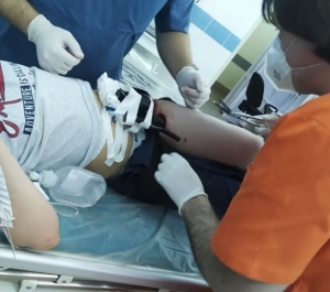 В больнице Пятигорска прооперировали мальчика с рулем от велосипеда в ноге