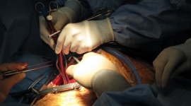 В Австралии кардиохирурги пересадили сердца умерших людей трем больным